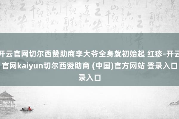 开云官网切尔西赞助商李大爷全身就初始起 红疹-开云官网kaiyun切尔西赞助商 (中国)官方网站 登录入口